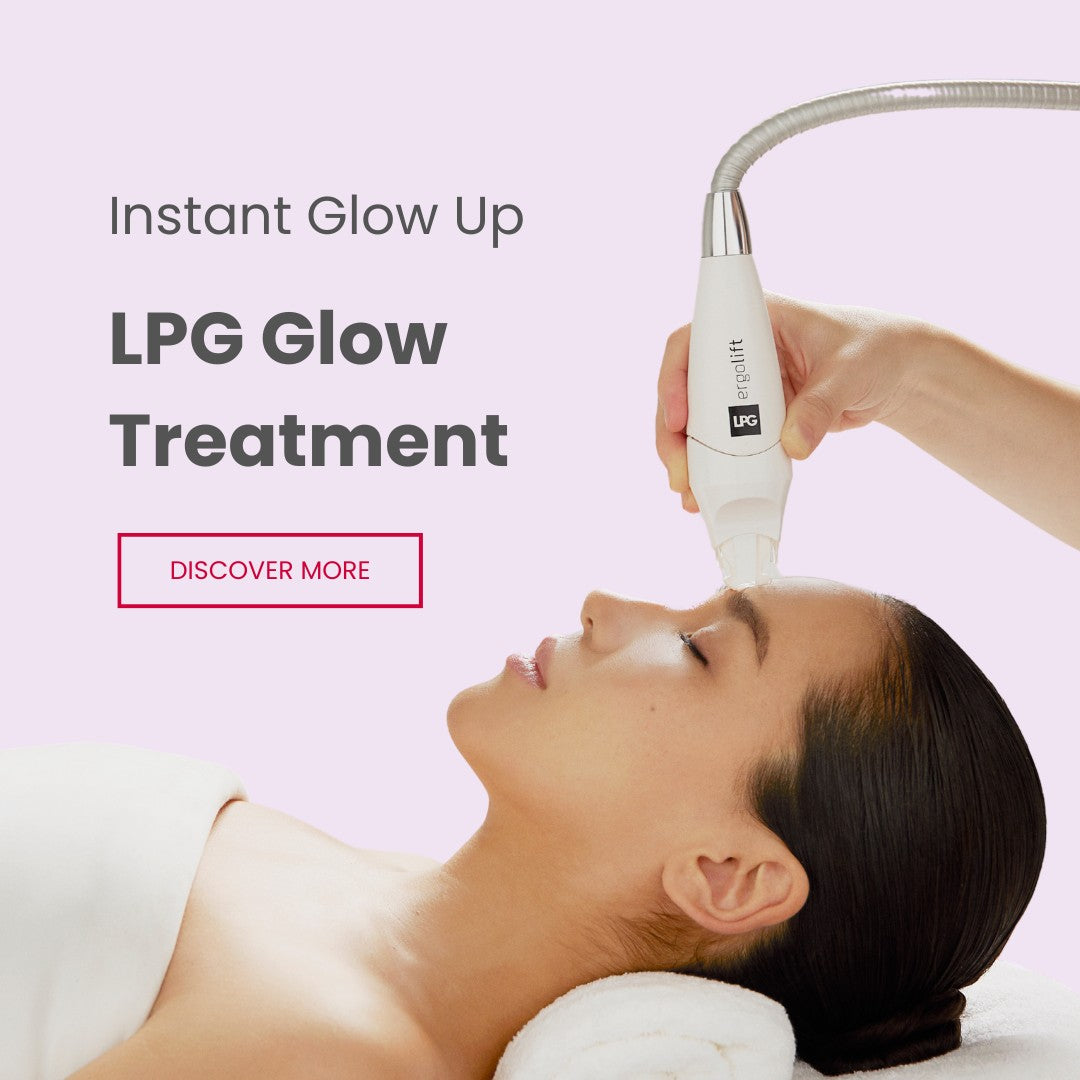 LPG Glow