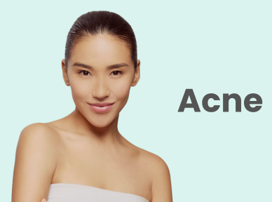 files/asterspring-singapore-treatment-acne-concern.png