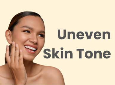 files/asterspring-singapore-treatment-dull-uneven-skin-tone-concern.png