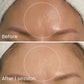 Exosome Rejuvenation Treatment