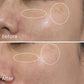 PhotoAgeing Reversal Therapy